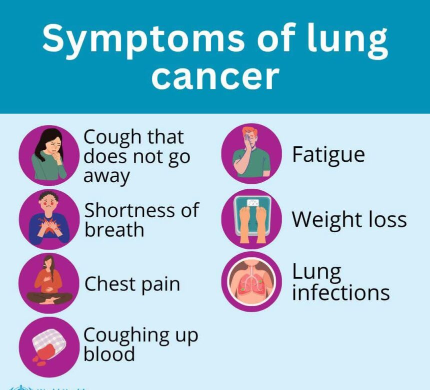 پھیپھڑوں کا کینسر - پھیپھڑوں کے کینسر کے بارے میں جامع رہنمائی